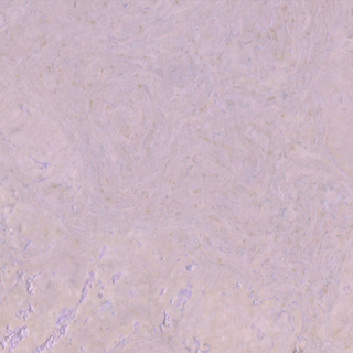 Picture of Globus Cork - Nugget Texture 18 x 24 Lavender